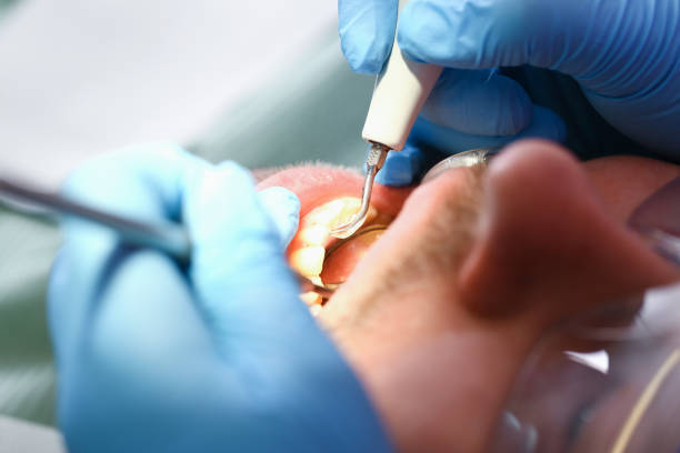 Best Emergency Treatment for Toothache in Brooklyn Center, MN
