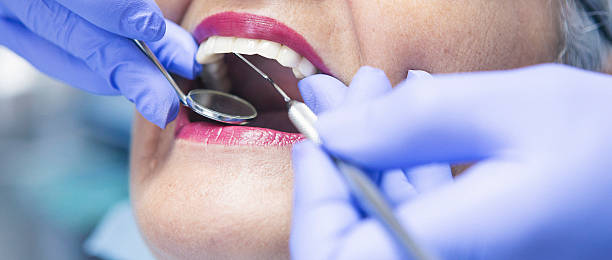 Best Emergency Tooth Extraction in Brooklyn Center, MN
